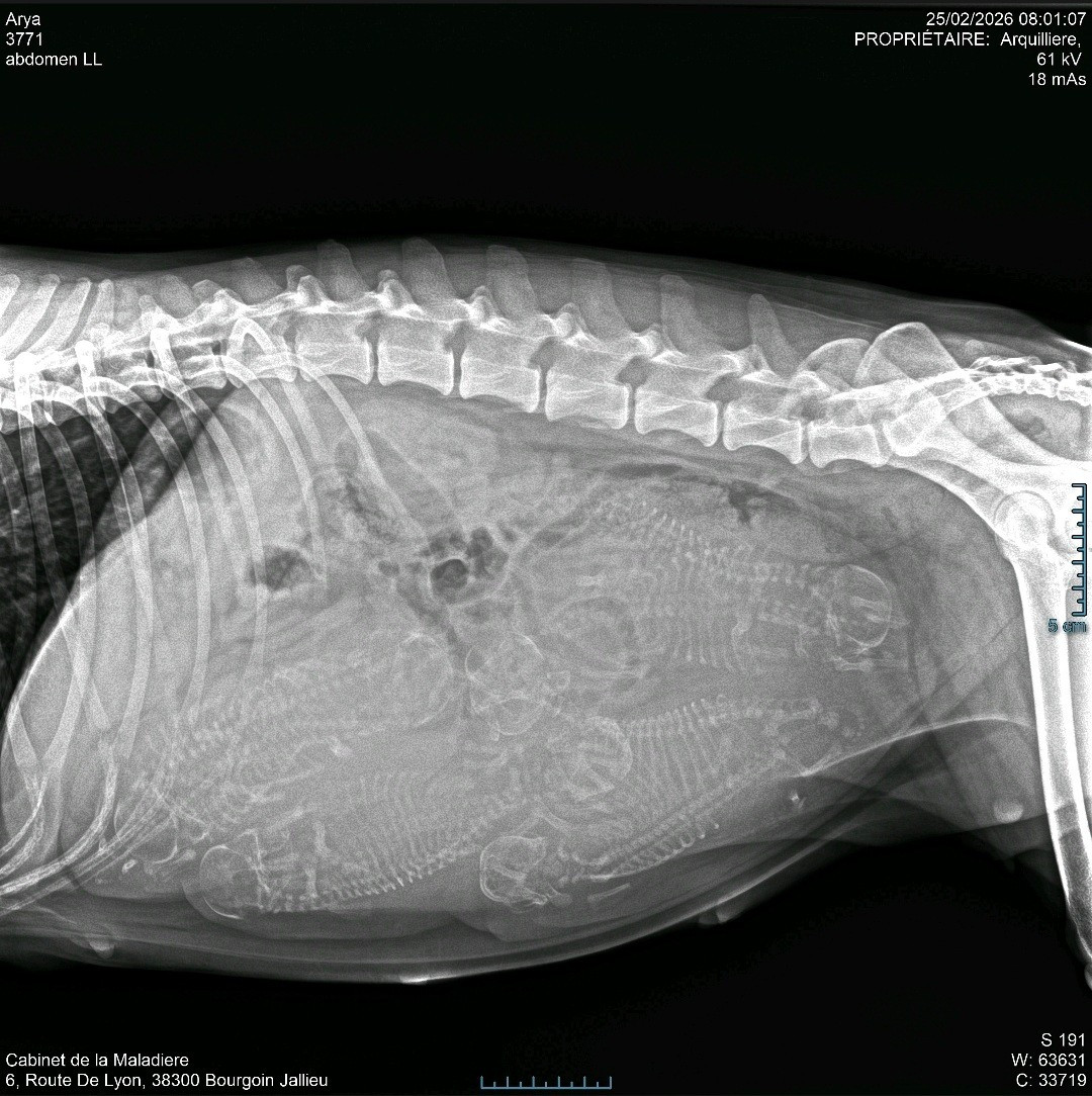 8 bb vus à la radio de gestation de Arya